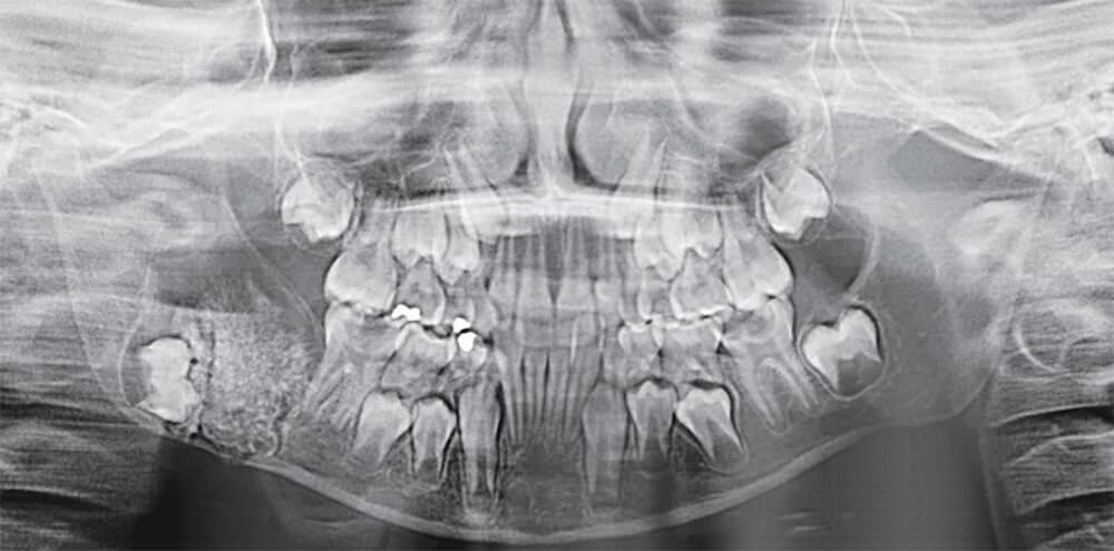 Figura 1: Radiografía Panorámica