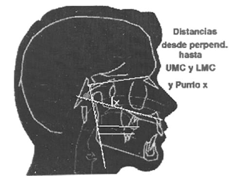 Fig. 3 Distancias