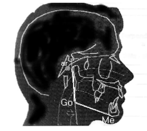 Fig. 5 Longitud de mandíbula