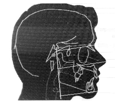 Fig. 8 Mediciones a tejidos blandos