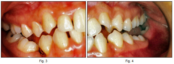 Fig. 3 - Fig. 4