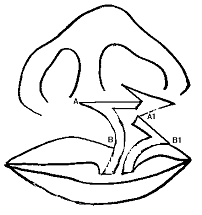 Figura Nº 2