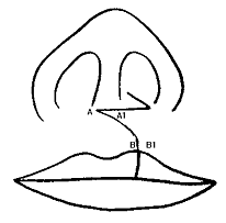 Figura Nº 3