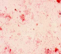 Figura 1. Coloración de Gram. Bacilos Gram Negativos.
