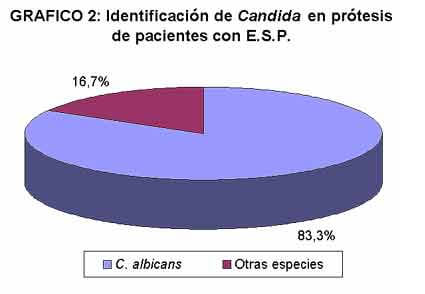 GRAFICO 2