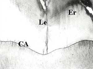 Foto 1: f: fosa - Le: Laminilla del esmalte - CAD: Conexión amelo dentinaria - Er: Estrías de Retzius. 4 X