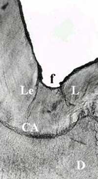 Foto 2: f: fosa - Le: Laminilla del esmalte - CAD: Conexión amelo dentinaria - D: Dentina. Azul de Metileno. 10 X.