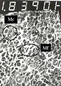 Foto 7: Mc: Microorganismos cocoides - Mf: Microorganismos filamentosos. MET 10950 X