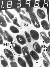 Foto 8: Mc: Microorganismos cocoides - Mf: Microorganismos filamentosos - Ei: Espacio intercelular. MET 22800 X