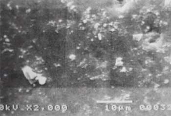Fig. 7 Microfotografía a 2.000 aumentos, mostrando depresiones de tamaño y forma irregular en la superficie del esmalte.