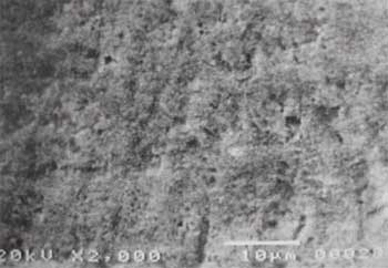Fig. 1 Microfotografía a 2.000 aumentos, representativa del tipo 0 que se caracterizó por presentar una superficie sin alteración en su estructura.