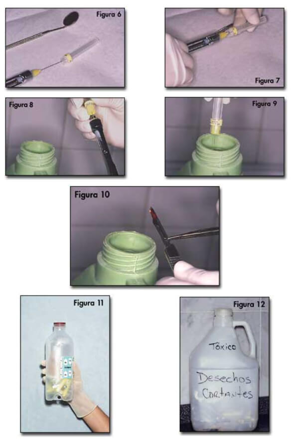 Al igual se hace con hojas de bisturí y porta agujas, van directo al envase especial. Se debe usar papel de aluminio o envoplast para proteger la lámpara. (Figs. 13 y 14)