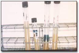 Figura 1: Crecimiento de T. tenax en medio de cultivo selectivo de Kupferberg (K.T.B.).