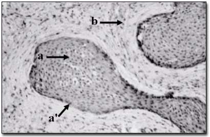 Figura 2 – Aspecto histológico a- isla epitelial; a’ - capa externa de células cuboides aplanadas; b – tejido conjuntivo Fuente: Sapp, 1997