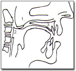 Figura N°4.1. Paladar blando, 2. Colgajo de mucosa faríngea de base superior, 3. Paladar óseo
