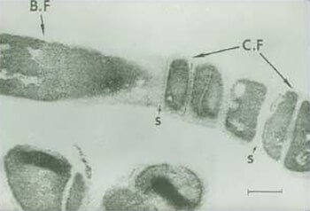 FIGURA 2: Corte de una cadena filamentosa de R. dentocariosa (48 horas), mostrando las formas cocoides (C.F) y las formas bacilares (B.F). También se distinguen los septos (S). (La barra representa 0,25 mm). Tomado de Roth y col.13
