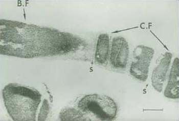 FIGURA 2: Corte de una cadena filamentosa de R. dentocariosa (48 horas), mostrando las formas cocoides (C.F) y las formas bacilares (B.F). También se distinguen los septos (S). (La barra representa 0,25 mm). Tomado de Roth y col.13
