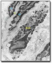 Fig. 8 En esta sección obsérvese la presencia de un capilar con un núcleo (Nu) de la célula endotelial rico en heterocromatina, con numerosas vesículas pinocíticas (cabeza de flecha), cavéolas (flecha) y prolongaciones del citoplasma hacia la luz (asterisco). La membrana basal esta ligeramente engrosada. Próximo al capilar se presenta un mastocito (MAS). Nótese la abundancia de colágeno X. 26.700