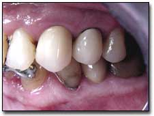 Fig. 11 Vista oclusal