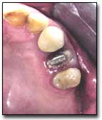 Fig. 15 Vista oclusal