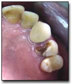 Fig. 17 Vista oclusal