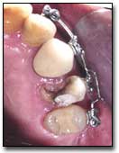 Fig. 5 Vista oclusal