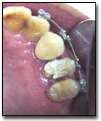 Fig. 7 Vista oclusal