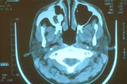 Figura 8. Tomografía de cráneo