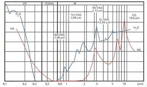 Longitud de onda en micrómetros Fig.2. Esquema que ilustra donde se sitúa la absorción de la longitud de onda correspondiente a los 2,94 um a nivel de la hidroxiapatita y el agua. (Fuente: Laser in odontostomatologia. Cap. 4. Pág. 46.)