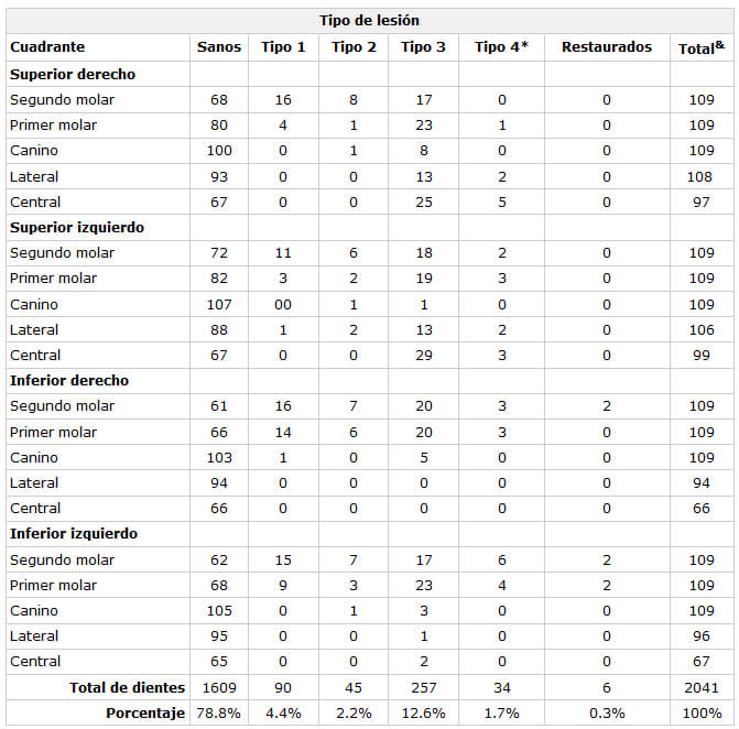 Cuadro 1. Distribución del tipo de lesión cariosa por tipo de dientes temporales presentes en boca en una población suburbana infantil de Campeche, México en el 2001