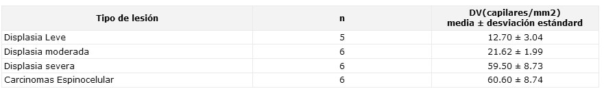 TABLA N° 2 Densidad vascular en las lesiones premalignas y malignas de la mucosa bucal.