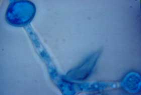 Morfología Microscópica de la colonia. Se observan clamidoconidios intercalares.(foto 4)