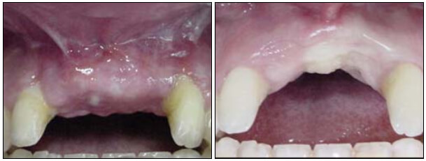 Fig. 10 Imágenes pre y post-operatorias