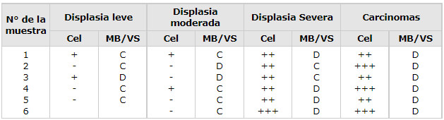 Tabla N° 2 Distribución de la expresión de laminina en lesiones premalignas y malignas de la mucvosa bucal