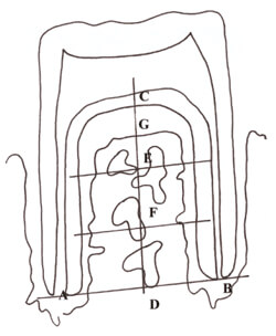 Figura 1. Para la definición del área de estudio, sobre la proyección de los cortes histológicos se trazó el segmento AB tangente a los ápices de las raíces mesial y distal. Desde el punto medio de AB, se trazó hacia el punto medio de la furcación el segmento CD. Este a su vez se dividió en tres segmentos iguales por los puntos E y F por los que se trazaron dos líneas paralelas a AB, las que dividieron al espacio interradicular en los tercios cervical, medio y apical. El segmento CD, determinó el punto G en su intersección con la cresta del hueso interradicular. La pérdida ósea se determinó sobre el segmento CD según la siguiente relación: PO = CG/CD x100