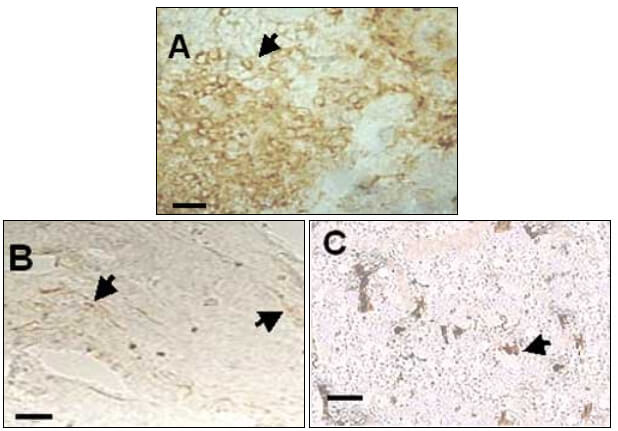 Fig. 1. Cortes de tejido gingival procesados mediante técnica de inmunoperoxidasa indirecta. (A) Localización inmunohistoquímica de la molécula CD19 en tejido conectivo. (B) Localización inmunohistoquímica de la molécula CD20 en tejido conectivo. (C) Localización inmunohistoquímica de la molécula CD22 en tejido conectivo. (En todos los casos las flechas indican las células con marcaje positivo.) Barras = 50 µm.