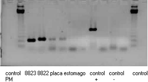 Caracterización de especies de H. pylori provenientes de muestras de placa dental y estómago de una muestra de la población venezolana