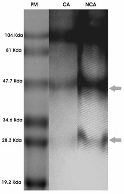 Figura 3 Perfil de proteínas totales salivales. Línea 1: patrón de peso molecular (PM), línea 2: consumidores de alcohol (CA) y línea 3: no consumidores (NCA)