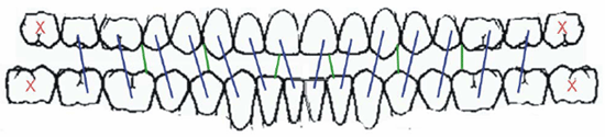 Gráfico 1 Pares y Unidades Oclusales registrados en dentición completa: 14 pares oclusales, 6 pares anteriores, 4 pares premolares, 4 pares molares, 15 unidades oclusales.