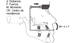 Partes de la máscara facial