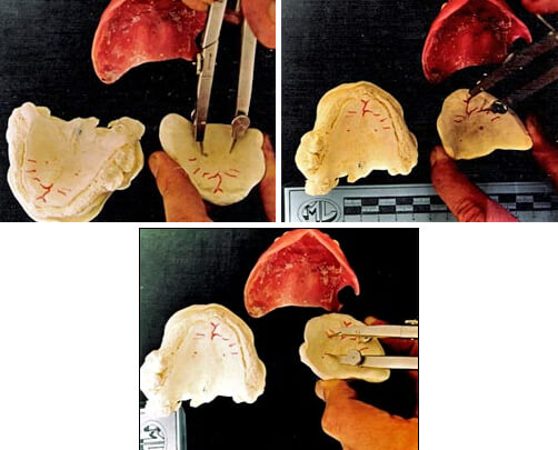 Imagen 3. Comparación de patrones de rugas palatinas, ante y postmortem en los modelos obtenidos.