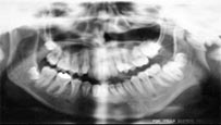 FIG. 4 Radiografía panorámica