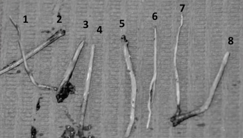 Figura 4. Conos de gutapercha de diferente diámetro y longitud. Fuente propia