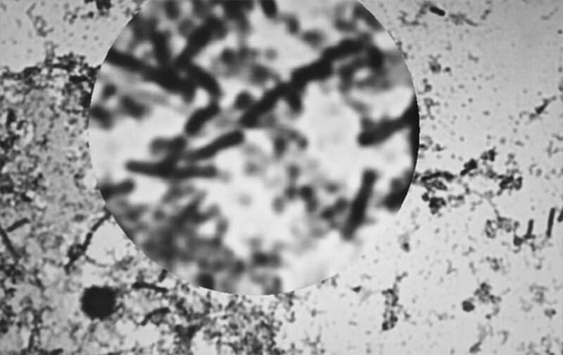 Figura 5. Fotografía microscópica de colonias de Escherichia coli. Fuente: Propia