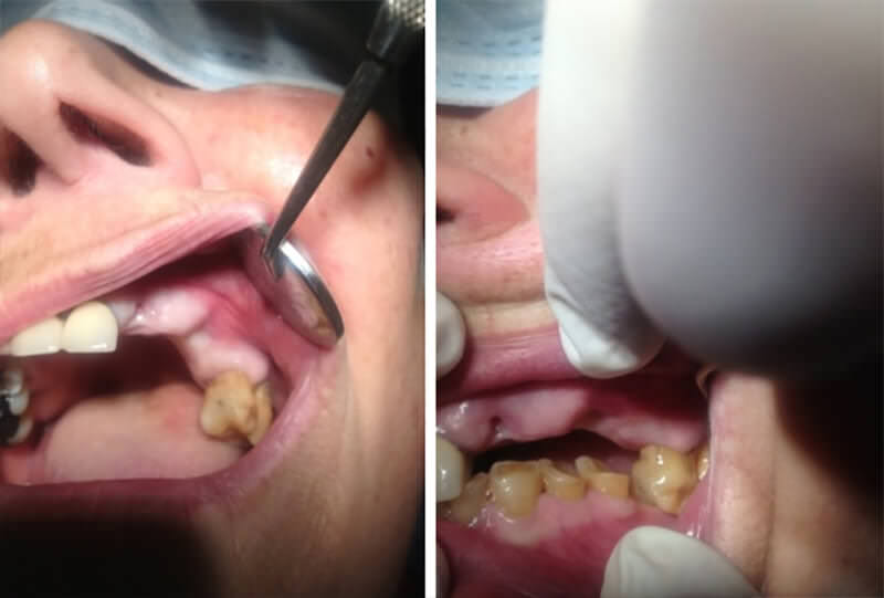 Figura 1. Imagen clínica preoperatoria