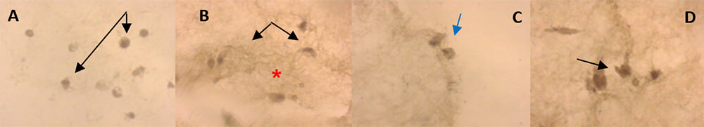 FIGURA  2. Células mesenquimales de la pulpa dentaria humana inmersas en la matriz natural de colágeno tipo I, a los veintiún días de inducción odontogénica-osteogénica.