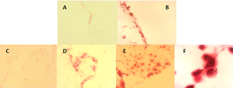 FIGURA 6.  Células mesenquimales de la pulpa dentaria humana sobre  la matriz de colágeno tipo I, catorce y veintiún días de inducción odontogénica-osteogénica.