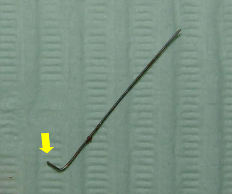 Fig 5. Segmento de aguja fracturada. Se evidencia el doblez de 3mm. con una angulación de 90 grados en el extremo proximal.