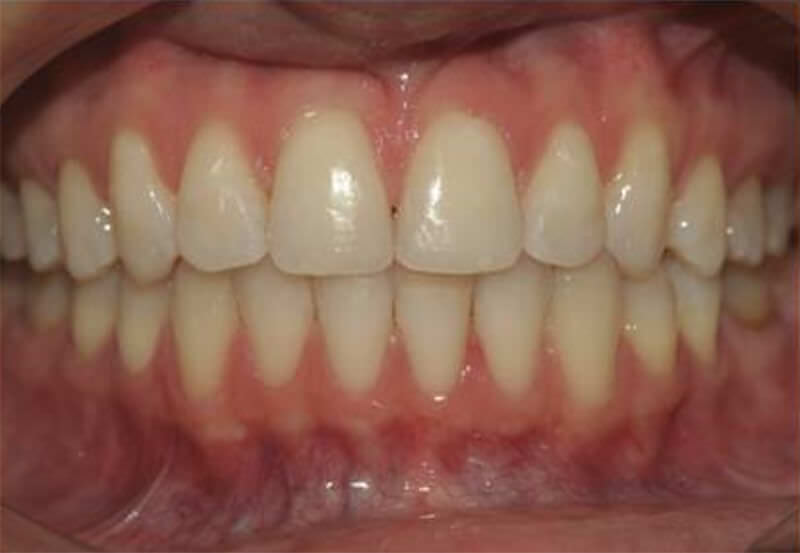 Figura 2 Aspecto dental final