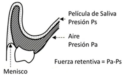 Figura 2 Retención debida al diferencial de presión entre la película de saliva y el aire
Tomado de Basker RM, Davenport JC 2